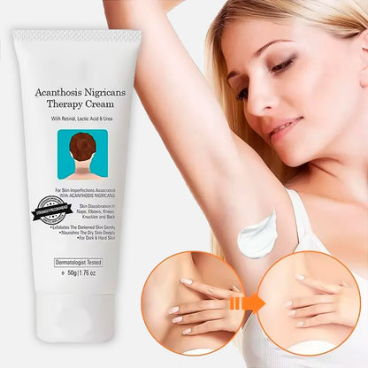 Crema Blanqueadora WhiteningCream®︎